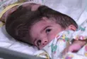 50 heures de traitement ont suivi... Réussite à isoler le cancer de Sammy rare!