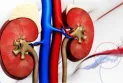 étude..10,7 million de cas de maladies des reins chaque année
