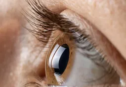 Symptoms to watch for indicating retinal detachment and vision loss