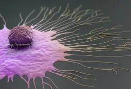 Russian doctor identifies factors of breast cancer development