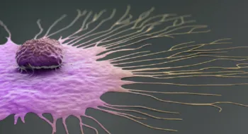 Russian doctor identifies factors of breast cancer development
