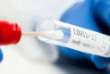 Ontario: 1700 hospitalizations reported versus 16 COVID-19 deaths