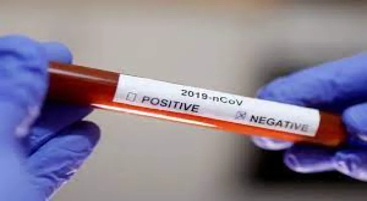 Ontario: Significant decline in the rate of COVID-19 infections