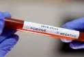 Ontario: Significant decline in the rate of COVID-19 infections