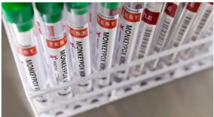 Canada reports 15 confirmed cases of monkeypox and expects more