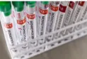 Canada reports 15 confirmed cases of monkeypox and expects more