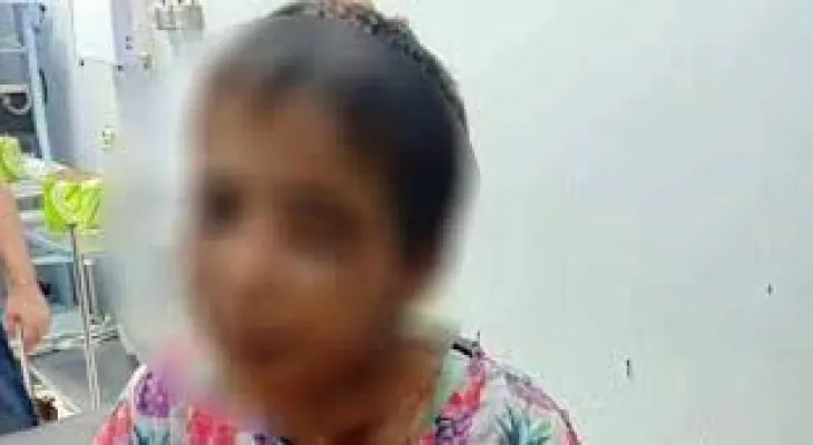 A 6-year-old girl was subjected to various types of torture at the hands of her mother.