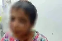 A 6-year-old girl was subjected to various types of torture at the hands of her mother.