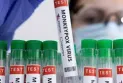 Ottawa: Opening of the first monkeypox vaccination clinic