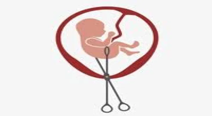 Canada: Abortion is possible but its costs burden low-income pockets