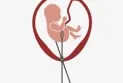Canada: Abortion is possible but its costs burden low-income pockets