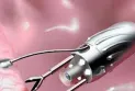 A new innovation for microscopic robots carrying drugs to the site of pain or disease inside the body