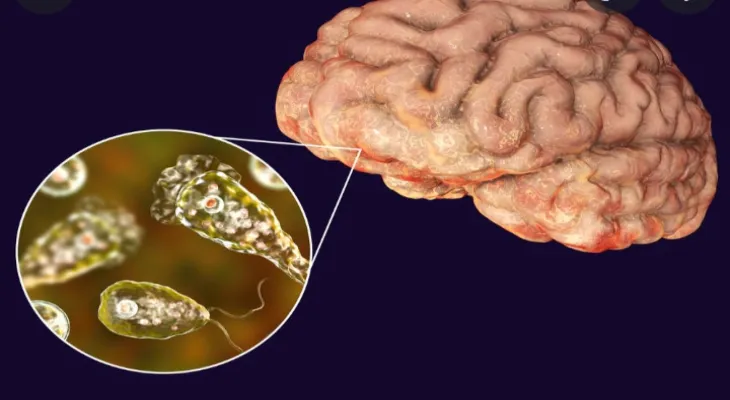 Centers for Disease Control: Brain-eating amoeba killed a child in Nebraska