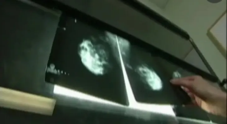 The Newfoundland Health Authority reviewed approximately 3,000 mammograms in search of potential problems.
