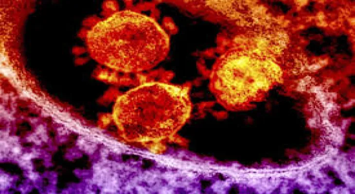 One death and two injuries after the announcement of a meningococcal disease outbreak in Toronto