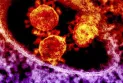 One death and two injuries after the announcement of a meningococcal disease outbreak in Toronto