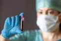Study confirms that blood type can predict the risk of stroke