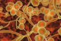 First appearance of the deadly fungus in Quebec
