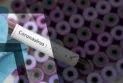 New coronavirus-like virus raises global concern