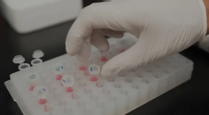 The new Alzheimer's drug looks promising according to early study results