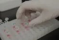 The new Alzheimer's drug looks promising according to early study results