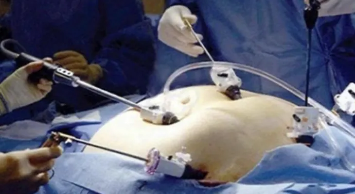 Warning .. Weight loss surgeries may cause neurological disease
