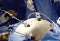 Warning .. Weight loss surgeries may cause neurological disease