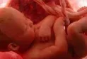 Study: Air pollution particles can reach fetuses' organs in their mothers' wombs