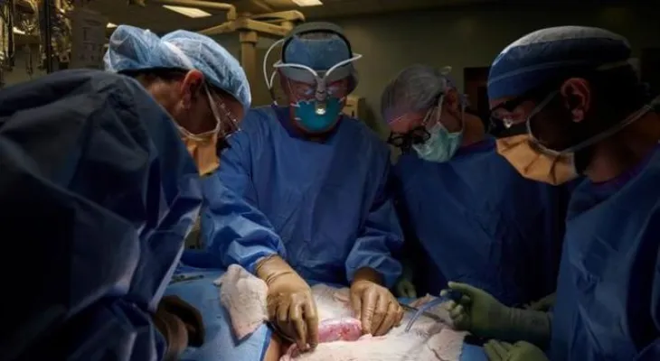 For the first time in the world.. successful intestinal transplant surgery