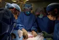 For the first time in the world.. successful intestinal transplant surgery