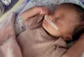 Ontario: Objection of parents of sick children to the policy limiting visits to the neonatal intensive care unit at Windsor Hospital