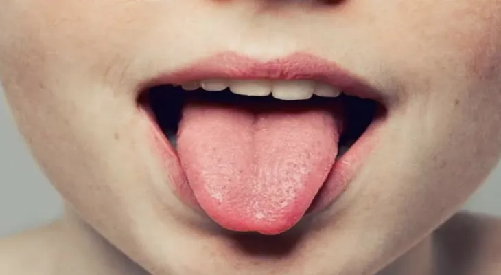 Beware.. These signs indicate that you have serious diseases