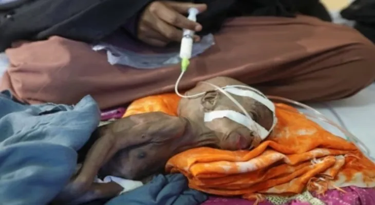 Why are we indifferent to the suffering of millions, there is a term for that