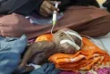 Why are we indifferent to the suffering of millions, there is a term for that