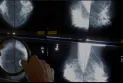 What is the most common cancer in Canada? Key points from the latest national report