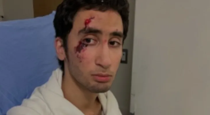 Syrian father seeks answers after his autistic son was shocked by Bill police