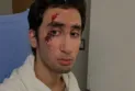 Syrian father seeks answers after his autistic son was shocked by Bill police