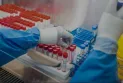 The Ottawa Public Health report has reported 13 new deaths from COVID-19.