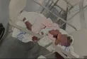A girl suffering from pneumonia waits nearly 40 hours in the emergency room in Ontario.