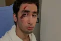 Mississauga: Police demonstrate how they interact with people with autism after a young Syrian man was shocked