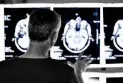 United States approves Alzheimer's drug and Canada follows