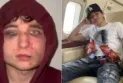 Toronto police direct a fifth person with charges of kidnapping the "crypto king"