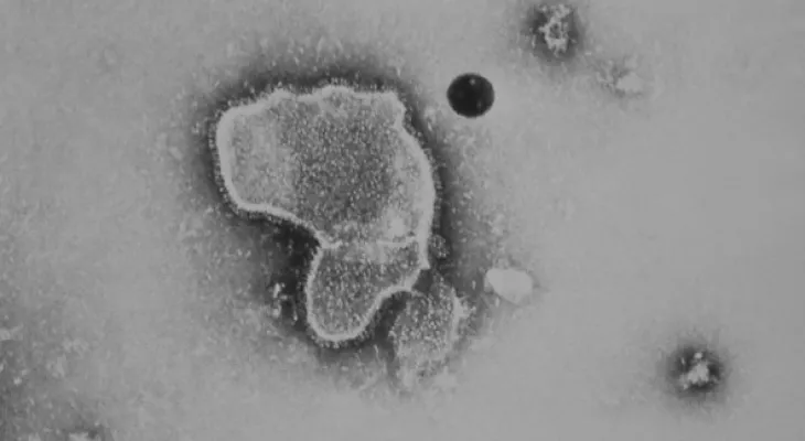 Health Canada approves the first vaccine for respiratory syncytial virus for adults aged 60 and older.