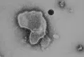 Health Canada approves the first vaccine for respiratory syncytial virus for adults aged 60 and older.