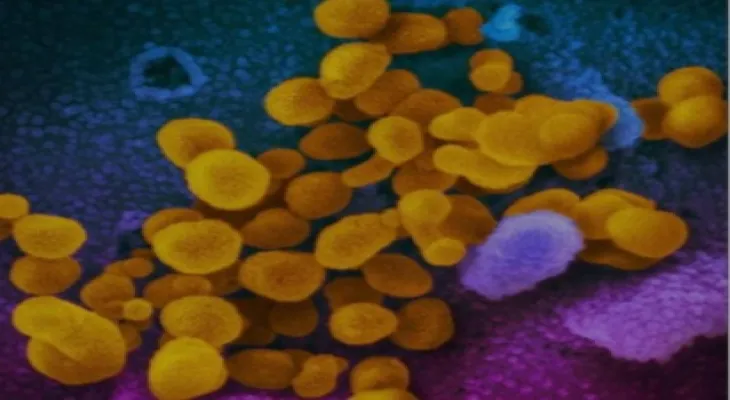 Infectious disease expert: Canada may see an increase in COVID-19 cases by late August.