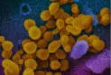 Infectious disease expert: Canada may see an increase in COVID-19 cases by late August.