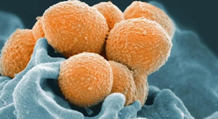 Record de cas d'infection invasive à Streptocoques du groupe A au Canada