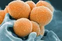 Record de cas d'infection invasive à Streptocoques du groupe A au Canada