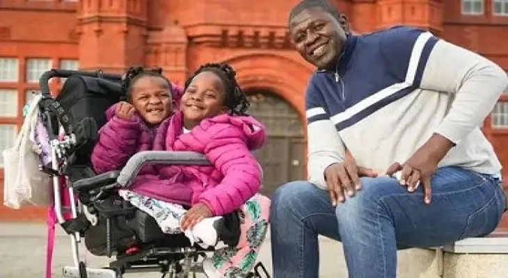 The story of the conjoined twins in Britain who no one expected to live