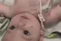 A woman discovers her infant son has a rare cancer through a phone camera flash